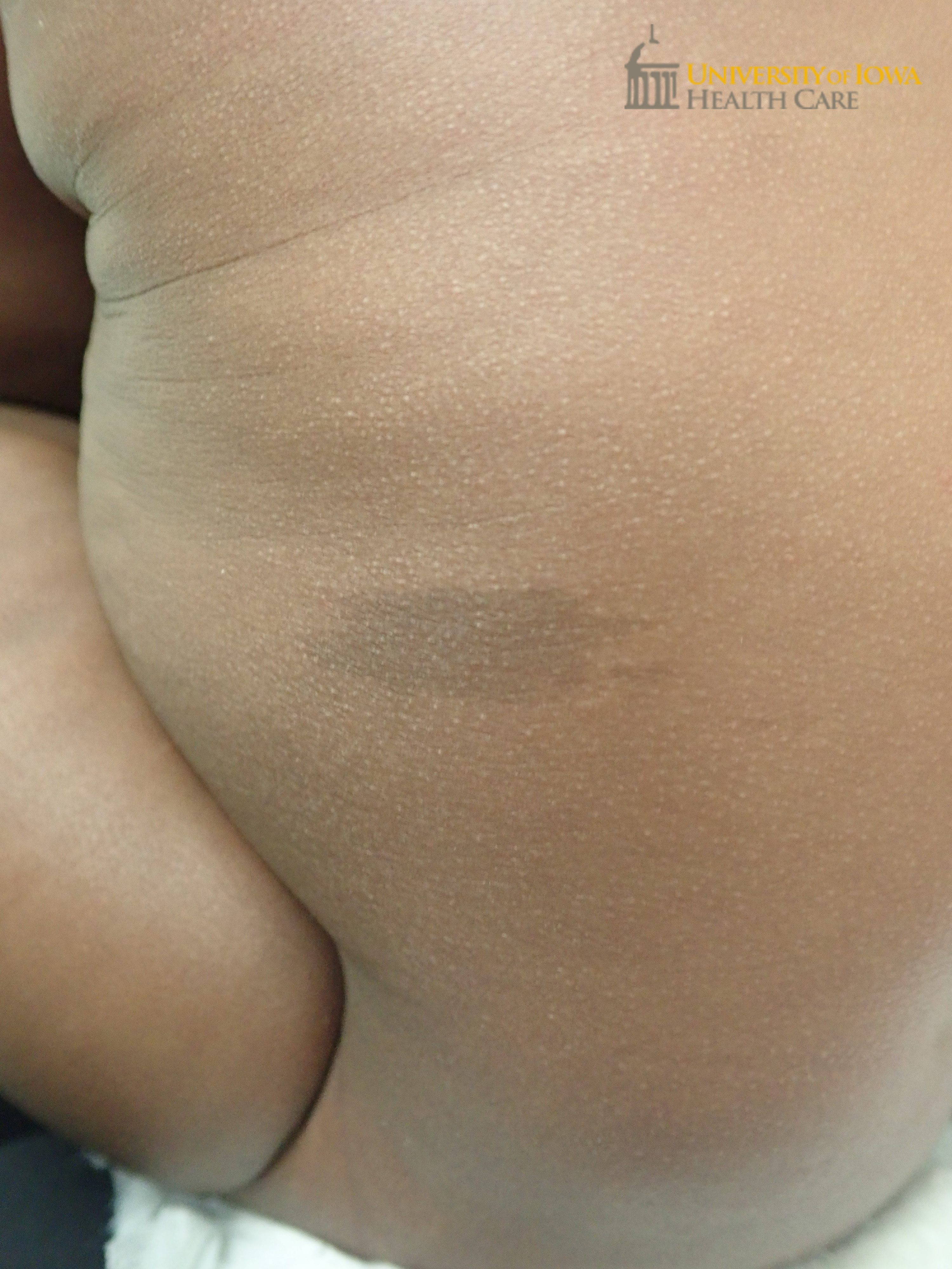 Brown patch on the trunk. (click images for higher resolution).